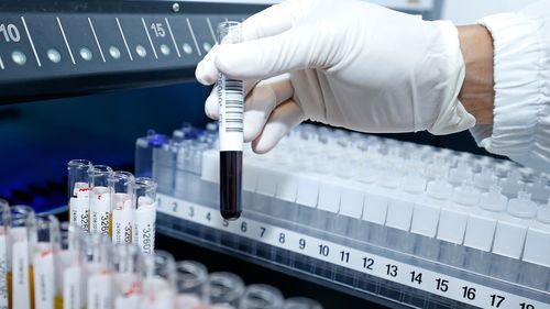 科學(xué)技術(shù)發(fā)展基金資助26項(xiàng)新型冠狀病毒感染科研項(xiàng)目助力技術(shù)開(kāi)發(fā)